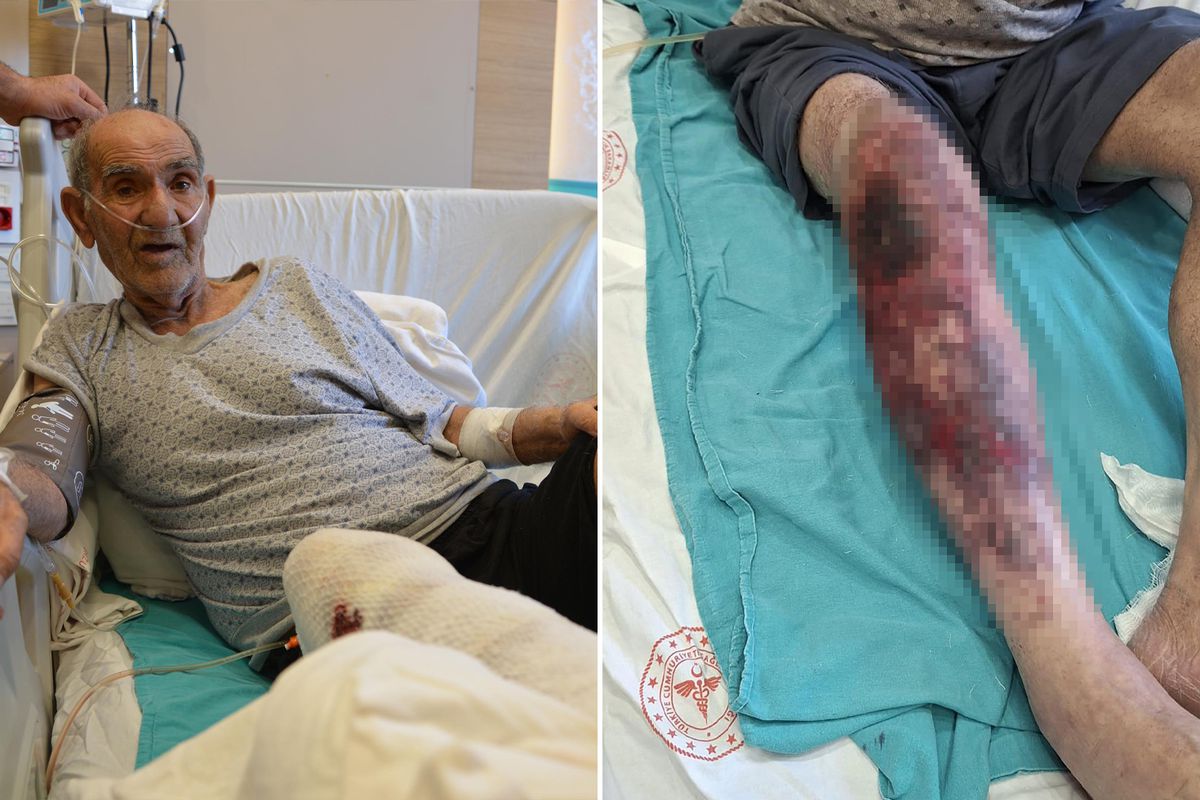 Herkesin başına gelebilir! Tıkalı lavaboyu açmak isterken yandı